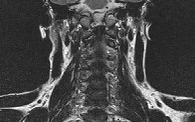 A columna cervical
